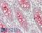 Mucin 13, Cell Surface Associated antibody, LS-B14186, Lifespan Biosciences, Immunohistochemistry paraffin image 