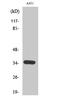 Cyclin Dependent Kinase 2 antibody, STJ92199, St John