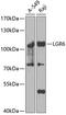 Leucine Rich Repeat Containing G Protein-Coupled Receptor 6 antibody, 22-904, ProSci, Western Blot image 