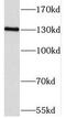 Protein Phosphatase 2 Regulatory Subunit B''Alpha antibody, FNab06719, FineTest, Western Blot image 