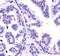 Dicer 1, Ribonuclease III antibody, NBP1-71691, Novus Biologicals, Immunohistochemistry frozen image 