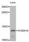 S100 Calcium Binding Protein A16 antibody, abx004615, Abbexa, Immunohistochemistry frozen image 