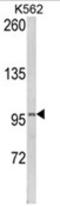 Lipin 2 antibody, AP18101PU-N, Origene, Western Blot image 