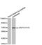 Zeta Chain Of T Cell Receptor Associated Protein Kinase 70 antibody, abx000514, Abbexa, Western Blot image 