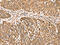 60S acidic ribosomal protein P2 antibody, CSB-PA558649, Cusabio, Immunohistochemistry paraffin image 