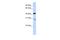 GRAM Domain Containing 2A antibody, A18430, Boster Biological Technology, Western Blot image 