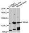 Transient receptor potential cation channel subfamily M member 5 antibody, abx126741, Abbexa, Western Blot image 