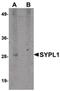 Synaptophysin Like 1 antibody, PA5-20797, Invitrogen Antibodies, Western Blot image 