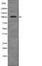 Receptor Tyrosine Kinase Like Orphan Receptor 1 antibody, PA5-64807, Invitrogen Antibodies, Western Blot image 