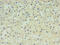 Alpha Fetoprotein antibody, CSB-MA027711E0m, Cusabio, Immunohistochemistry frozen image 