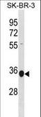 Mitochondrial Ribosomal Protein L45 antibody, LS-C157970, Lifespan Biosciences, Western Blot image 