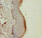 Keratin 6A antibody, LS-C675971, Lifespan Biosciences, Immunohistochemistry paraffin image 