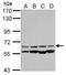 Chaperonin Containing TCP1 Subunit 8 Like 2 antibody, NBP2-15865, Novus Biologicals, Western Blot image 