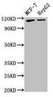 ATPase Phospholipid Transporting 9A (Putative) antibody, orb52382, Biorbyt, Western Blot image 