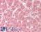 Toll Like Receptor 3 antibody, LS-B13312, Lifespan Biosciences, Immunohistochemistry paraffin image 