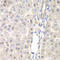 Deltex E3 Ubiquitin Ligase 2 antibody, LS-C349113, Lifespan Biosciences, Immunohistochemistry paraffin image 