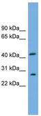 IL-12 antibody, TA340081, Origene, Western Blot image 