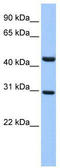 TUB Like Protein 3 antibody, TA334012, Origene, Western Blot image 