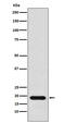 NME/NM23 Nucleoside Diphosphate Kinase 1 antibody, M01334-2, Boster Biological Technology, Western Blot image 