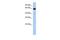 Leucine Rich Repeat Transmembrane Neuronal 1 antibody, GTX45195, GeneTex, Western Blot image 