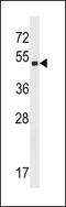 Zinc Finger Protein 559 antibody, 60-050, ProSci, Western Blot image 