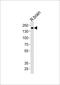 Insulin Receptor Related Receptor antibody, PA5-49383, Invitrogen Antibodies, Western Blot image 