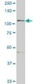 GTF2I Repeat Domain Containing 1 antibody, H00009569-M01, Novus Biologicals, Western Blot image 