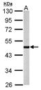Serine/Threonine Kinase 32B antibody, NBP1-32343, Novus Biologicals, Western Blot image 