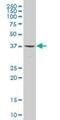Frizzled Related Protein antibody, H00002487-M05, Novus Biologicals, Western Blot image 