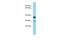 Potassium Channel Tetramerization Domain Containing 1 antibody, A09148, Boster Biological Technology, Western Blot image 