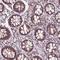 Zinc Finger Protein 555 antibody, NBP2-49182, Novus Biologicals, Immunohistochemistry frozen image 