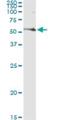 FAS antibody, H00002194-M01, Novus Biologicals, Immunoprecipitation image 