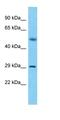 SLX1 Homolog B, Structure-Specific Endonuclease Subunit antibody, orb327106, Biorbyt, Western Blot image 