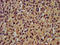 Proteasome Maturation Protein antibody, LS-C397005, Lifespan Biosciences, Immunohistochemistry paraffin image 