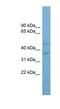 Arylacetamide Deacetylase Like 4 antibody, NBP1-91584, Novus Biologicals, Western Blot image 