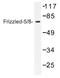 Frizzled-5 antibody, AP01257PU-N, Origene, Western Blot image 