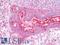 Huntingtin antibody, LS-C24591, Lifespan Biosciences, Immunohistochemistry frozen image 