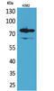 Forkhead Box P1 antibody, STJ96578, St John