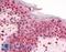 GLI Family Zinc Finger 2 antibody, LS-B2808, Lifespan Biosciences, Immunohistochemistry frozen image 