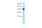 Ring Finger Protein 135 antibody, 28-151, ProSci, Western Blot image 