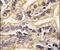 Colony Stimulating Factor 1 Receptor antibody, PA5-14569, Invitrogen Antibodies, Immunohistochemistry paraffin image 