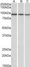 Aconitase antibody, 42-525, ProSci, Western Blot image 