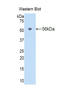 Interleukin 18 Binding Protein antibody, LS-C294870, Lifespan Biosciences, Western Blot image 