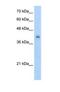 V-set and immunoglobulin domain-containing protein 4 antibody, NBP1-69631, Novus Biologicals, Western Blot image 