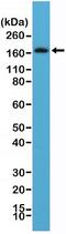 Platelet Derived Growth Factor Receptor Beta antibody, NBP2-61578, Novus Biologicals, Western Blot image 