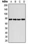BMX Non-Receptor Tyrosine Kinase antibody, MBS822093, MyBioSource, Western Blot image 