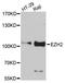 Enhancer Of Zeste 2 Polycomb Repressive Complex 2 Subunit antibody, A13867, ABclonal Technology, Western Blot image 