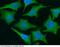 Interleukin 33 antibody, 10368-MM03, Sino Biological, Immunohistochemistry paraffin image 