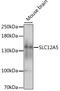 Solute Carrier Family 12 Member 5 antibody, LS-C750455, Lifespan Biosciences, Western Blot image 