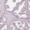 TIMELESS-interacting protein antibody, HPA039704, Atlas Antibodies, Immunohistochemistry frozen image 